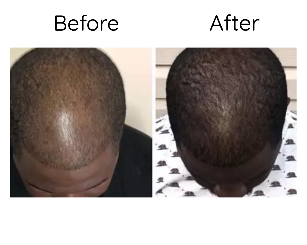 Alpha Scalp Oil